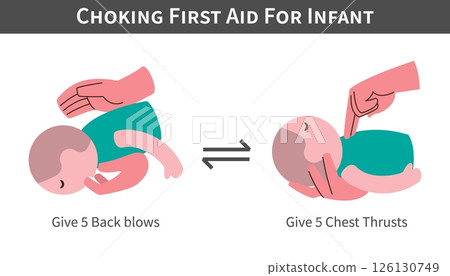 Choking First Aid For Infant cartoon illustration . Back blows and switch with chest thrusts . Flat design . Vector . 126130749