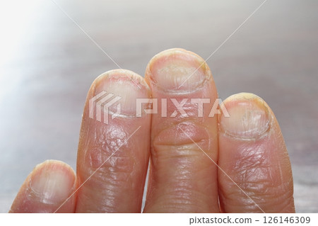 奇怪的指甲 奇怪的指甲 126146309