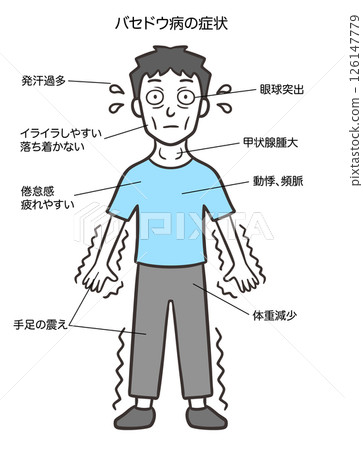 Signs and symptoms of Graves' disease in men 126147779