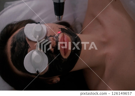 A woman is undergoing a carbon laser facial treatment. Her face is covered with a black carbon mask, protective goggles shield her eyes. A woman is undergoing a carbon laser facial treatment. Her face is covered with a black carbon mask, protective goggles shield her eyes. 126149657
