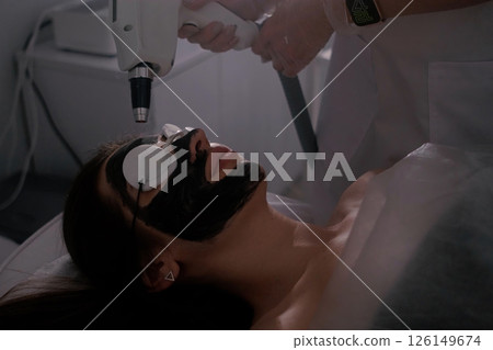 A woman is undergoing a carbon laser facial treatment. Her face is covered with a black carbon mask, protective goggles shield her eyes. A woman is undergoing a carbon laser facial treatment. Her face is covered with a black carbon mask, protective goggles shield her eyes. 126149674