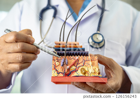Asian dermatologist doctor holding skin structure model anatomy for treatment in hospital, hair transplant. Asian dermatologist doctor holding skin structure model anatomy for treatment in hospital, hair transplant. 126156243