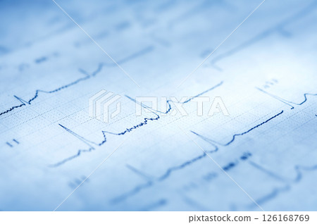 Close up of an electrocardiogram Close up of an electrocardiogram 126168769
