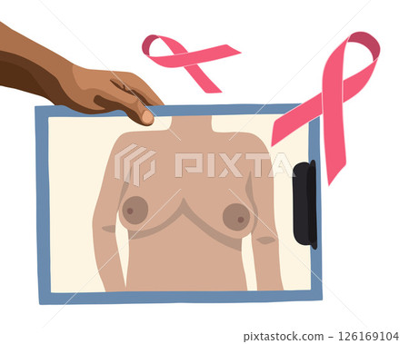 Vector isolated illustration of breast cancer diagnosis and treatment. World Breast Cancer Day. 126169104