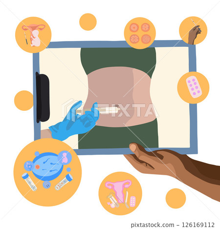 Vector isolated illustration of ovulation stimulation process. Egg donation. Ovary stimulation. Egg freezing. Artificial insemination. 126169112