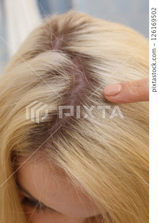 Woman showing blonde hair roots Woman showing blonde hair roots 126169502