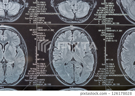 Magnetic resonance imaging or MRI image of the brain 126178028