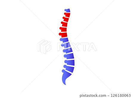 Scoliosis medical poster 126180063
