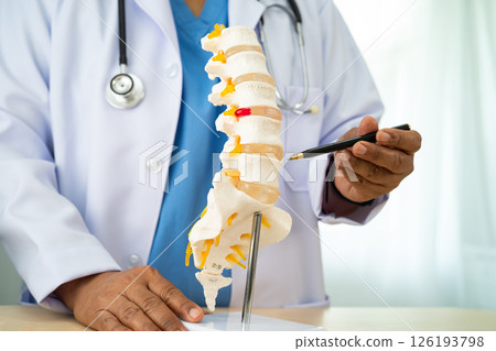 Doctor with lumbar vertebra bone skeleton and nerve model for treatment in the orthopedic department. 126193798
