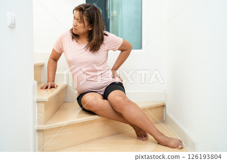 Asian lady fall down the stairs and pain at knee because slippery surfaces. 126193804