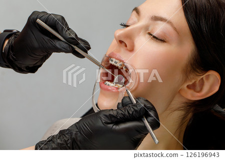 Orthodontist performing braces checkup on patient 126196943