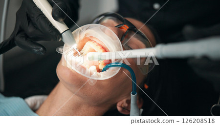 Equipment, medical and mouth of patient with dentist in office for appointment, checkup or operation. Dental, filling or hygiene with medicine professional and woman at clinic for healthcare 126208518