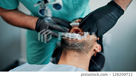 Medical procedure, mouth and patient with dentist in office for checkup or oral operation. Dental hygiene, healthcare or tooth filling with medicine professional and man at clinic for dentistry 126209711