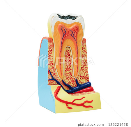 Dental implant, artificial tooth roots into jaw isolated on white background with clipping path. Dental implant, artificial tooth roots into jaw isolated on white background with clipping path. 126221458