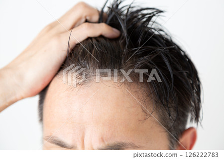 中年男子頭髮稀疏 中年男子頭髮稀疏 126222783
