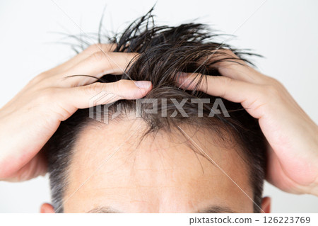 中年男子頭髮稀疏 126223769