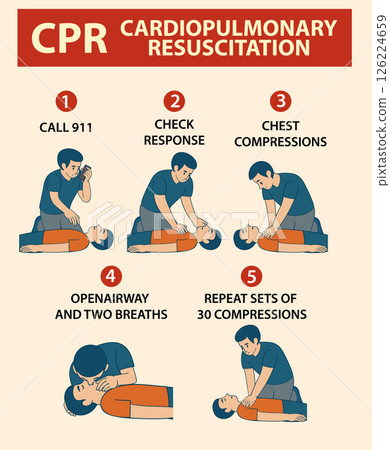 Step-by-Step CPR Instructional Vector Illustration Step-by-Step CPR Instructional Vector Illustration 126224659
