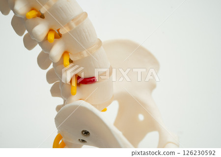 Human spinal nerve and bone with Intervertebral disc. 126230592