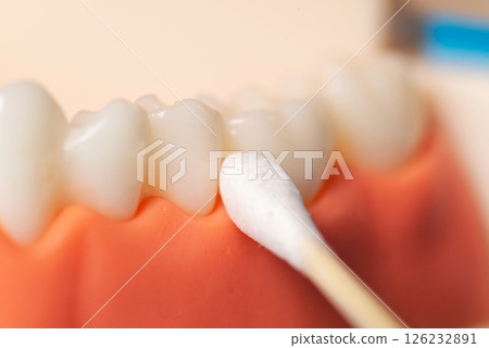 Taking a bacteriological smear from the gingival canal for staphylococci and streptococci bacteria, macro Taking a bacteriological smear from the gingival canal for staphylococci and streptococci bacteria, macro 126232891