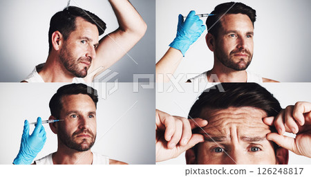 Anti aging, needle and man in collage for skincare for filler injection, hair growth or aesthetic treatment. Collagen benefits, wrinkles or studio with alopecia cosmetics or serum on white background Anti aging, needle and man in collage for skincare for filler injection, hair growth or aesthetic treatment. Collagen benefits, wrinkles or studio with alopecia cosmetics or serum on white background 126248817