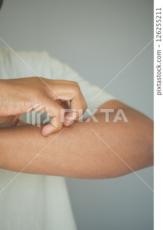 Person scratching their arm while standing indoors Person scratching their arm while standing indoors 126255211
