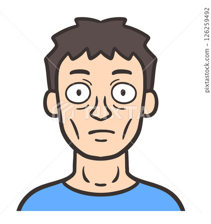 一名患有格雷夫茲病的男子的臉部 一名患有格雷夫茲病的男子的臉部 126259492