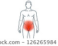 Infographics pelvic discomfort information about pelvic pain in men using red shading on silhouette , increasing health awareness, infographic design improves patient engagement in education 126265984
