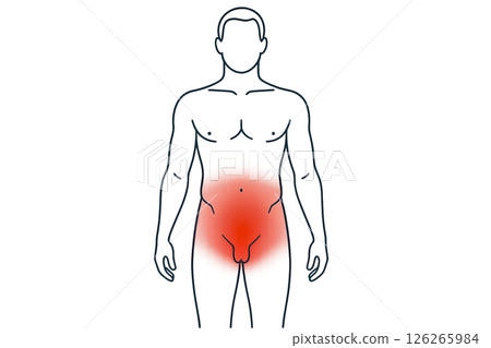 Infographics pelvic discomfort information about pelvic pain in men using red shading on silhouette , increasing health awareness, infographic design improves patient engagement in education 126265984