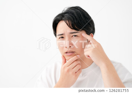 Men suffering from skin problems, beard 126281755