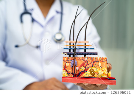Hair transplant, Asian dermatologist doctor holding skin structure anatomy model for treatment in hospital. 126296051