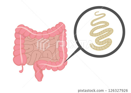 Tapeworm living in human intestine, causing parasitic infection Tapeworm living in human intestine, causing parasitic infection 126327926