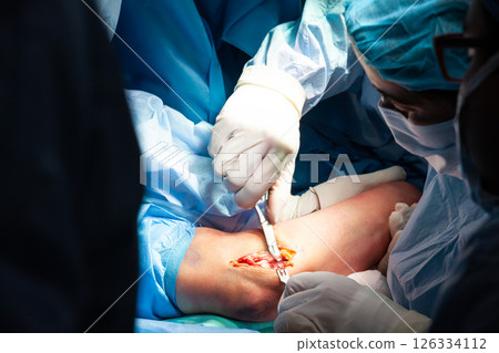 Female doctor performing a surgery. Orthopedic surgeon. Surgery and insurance concept. 126334112