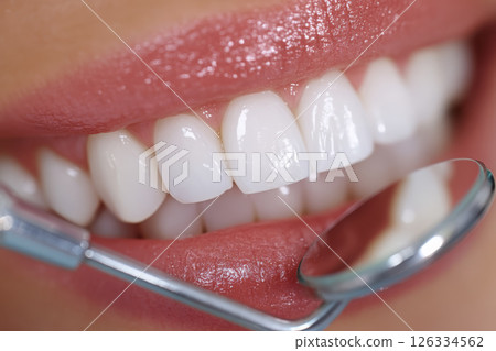 Detailed image of a woman's smile with perfect, white, and well-aligned teeth Detailed image of a woman's smile with perfect, white, and well-aligned teeth 126334562