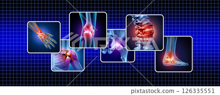 Human Joints Pain Human Joints Pain 126335551