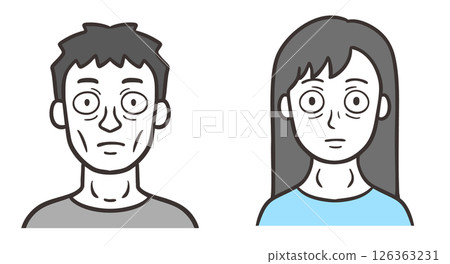 出現格雷夫茲病症狀的男性和女性的臉部 126363231