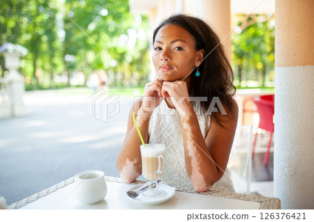 Young black woman with vitiligo sitting at 126376421