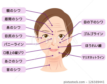 Types of wrinkles Women's face Beauty 126389441