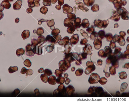 Lots of mold spores Lots of mold spores 126391008