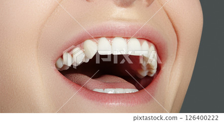 Dental Beauty. Beautiful Macro with perfect White Teeth. Fashion Naturel Lips Make-up. Whitening Tooth, Wellness Treatment 126400222