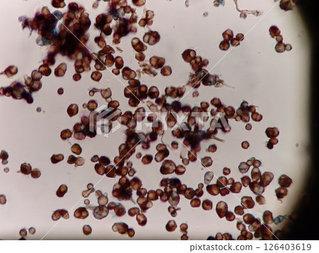 黑色黴菌孢子 126403619