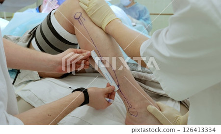 Surgical team marking precise vein operation lines on patient's leg, working inside sterile operating room with professional medical equipment 126413334