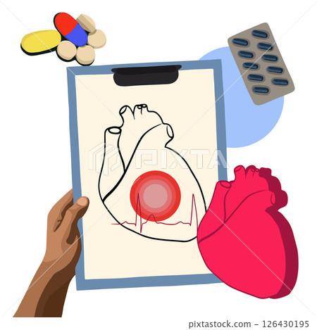 Vector isolated illustration of heart disease treatment. Heart disease diagnosis. Electrocardiogram study. Heart rhythm. Ischemic heart disease. 126430195