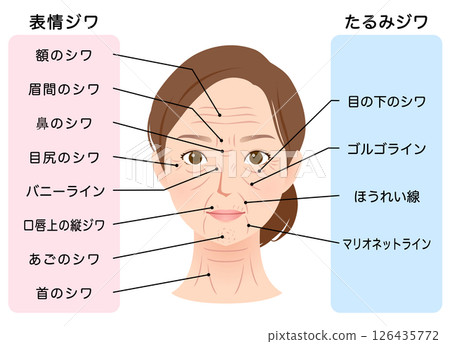 皺紋的類型 女性面部 美容 皺紋的類型 女性面部 美容 126435772