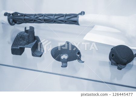 Implants and prostheses printed on 3D printer from biocompatible titanium powder. Individualized human implants hip joints and implants for replacing tubular bones. Endoprostheses. Bioengineering 126445477