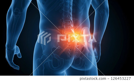 Medical illustration of a man seen from an angle, showing lower back pain and muscle tension. 3D CG highlighting inflammation and injury. Medical illustration of a man seen from an angle, showing lower back pain and muscle tension. 3D CG highlighting inflammation and injury. 126453227