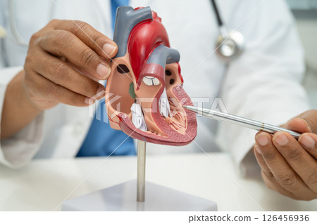 Cardiovascular disease CVD, Asian doctor holding human anatomy model for learn and treat heart disease. Cardiovascular disease CVD, Asian doctor holding human anatomy model for learn and treat heart disease. 126456936