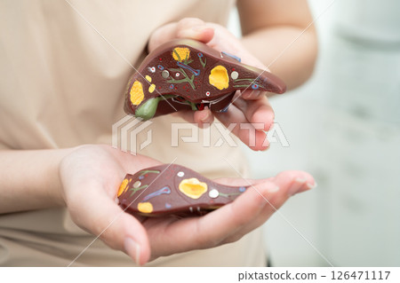 Cirrhosis, Liver cancer, fatty liver, Asian women with liver human anatomy model in World Hepatitis Day. 126471117