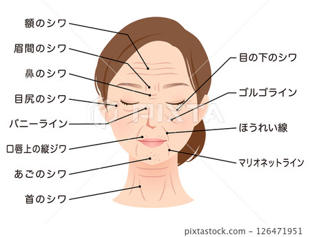 皺紋的類型 女性面部 美容 皺紋的類型 女性面部 美容 126471951