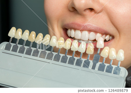 Tooth color matching with shade guide 126489879