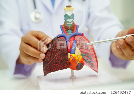 Cirrhosis, Liver cancer, fatty liver, Asian woman with liver human anatomy model. 126492487